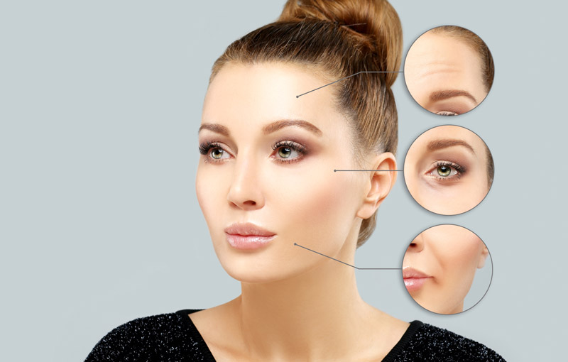 BOTOX® Treatments
