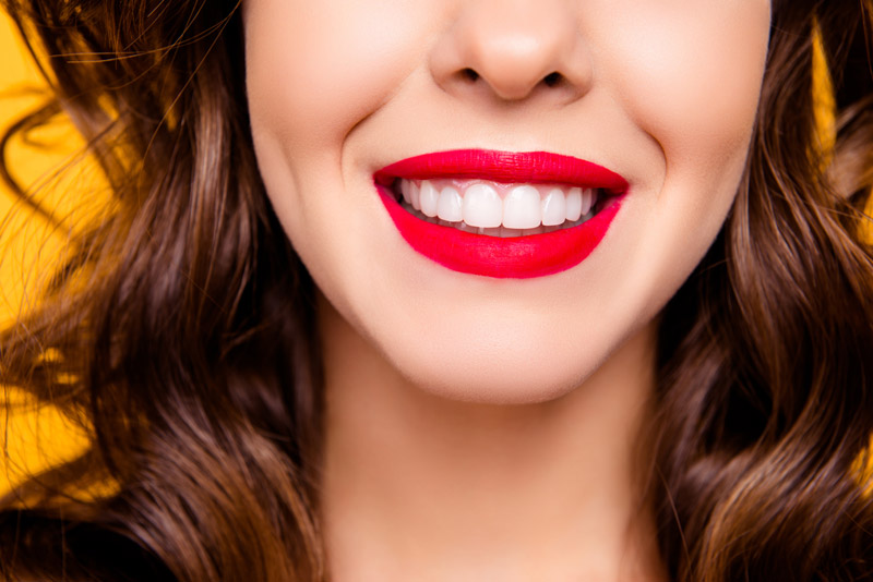 Smile Makeover