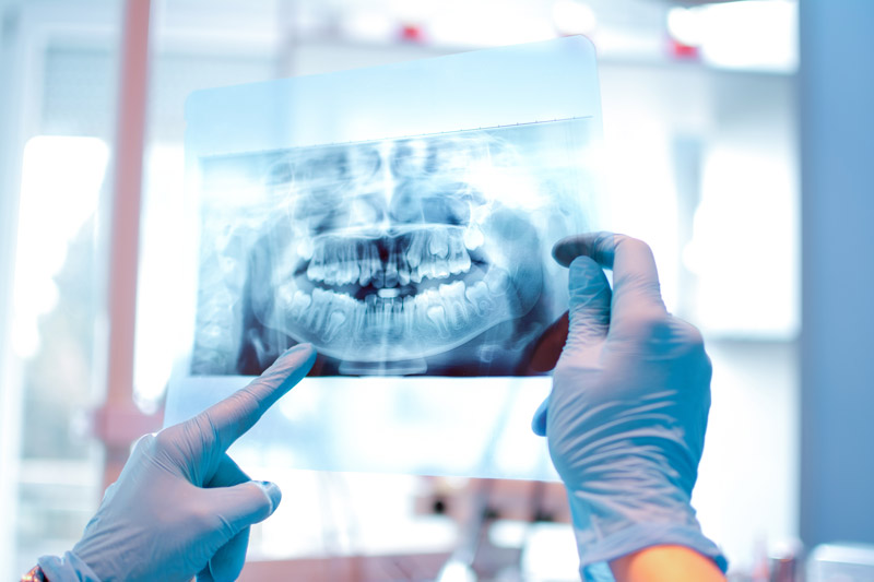 Digital X-Rays